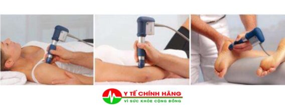 Điều Trị Viêm Khớp Bằng Sóng Xung Kích