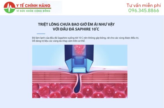 Máy Triệt Lông Nanotime B65PRO