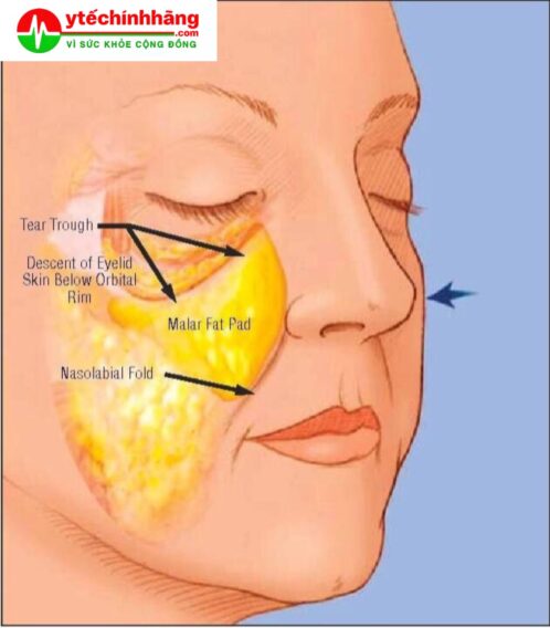 Thiết Bị Làm Đẹp Bằng Sóng Tần Số Vô Tuyến RF