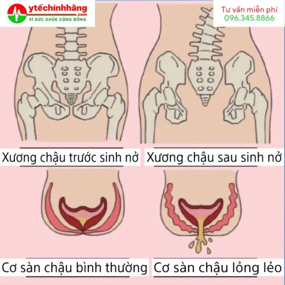 Luyện tập Kegel cho bà bầu đúng cách