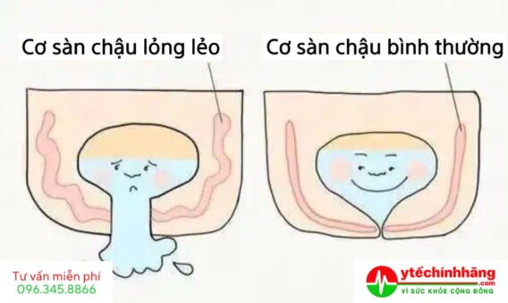 Luyện tập Kegel cho bà bầu đúng cách