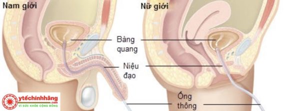 Ong Thong Tieu Sonde Nelaton 1