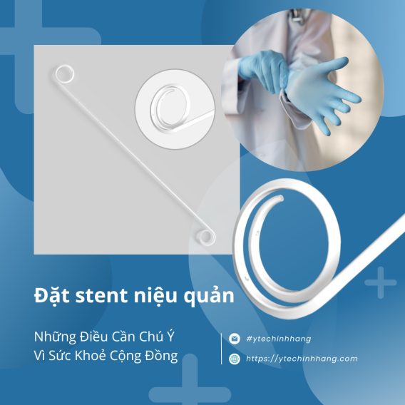 Đặt Stent Niệu Quản