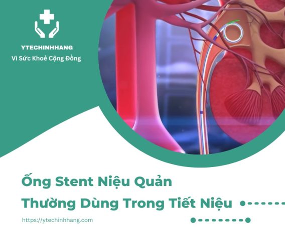 Ống Stent Niệu Quản Thường Dùng Trong Tiết Niệu