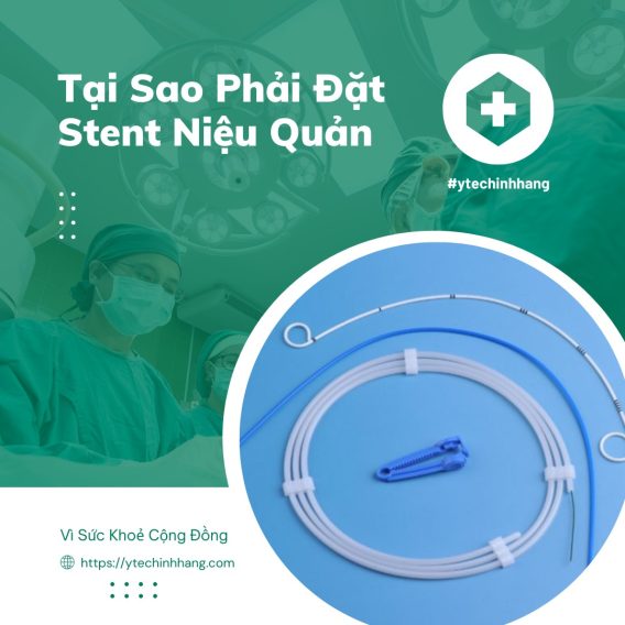 Tại Sao Nên Đặt Stent Niệu Quản