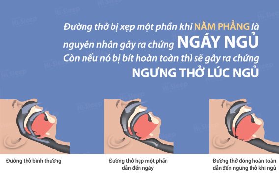 Phỏng Vấn Bệnh Nhân Tăng Huyết Áp Tập 1