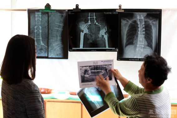 Lưu Ý Sau Cấy Ghép Hợp Kim Titan Vào Cơ Thể 10 8f621938372d915d9fa96a698a9a5f9b