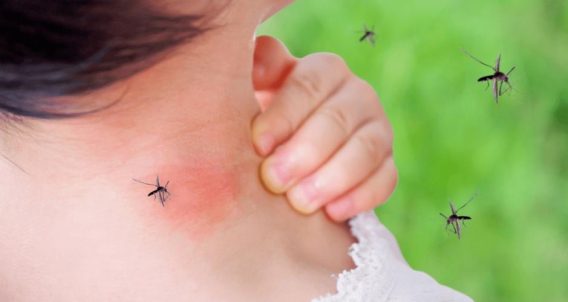 5 Bệnh Mùa Hè Nhận Biết Sớm Để Bảo Vệ Sức Khỏe 12 5 Loại Bệnh Mùa Hè Nhận Biết Sớm Để Bảo Vệ Sức Khỏe